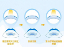 【瞳康智能眼镜】为什么多数人都拒绝做近视激光手术